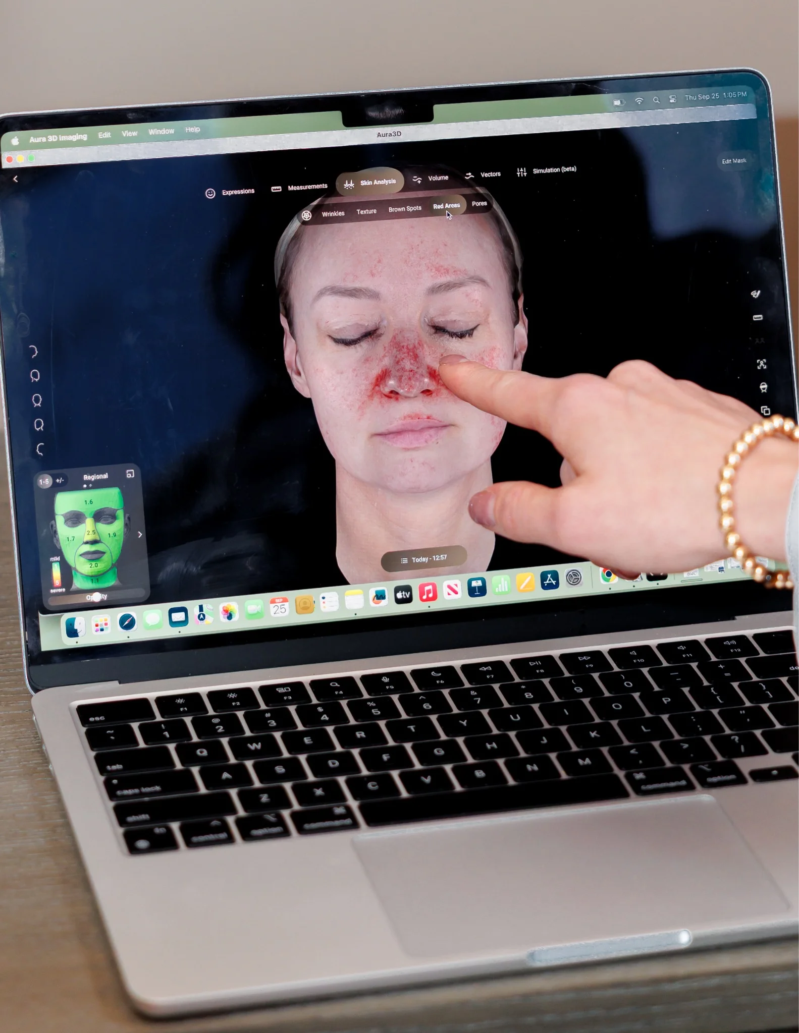 Aura Reality Skin Analysis (3)